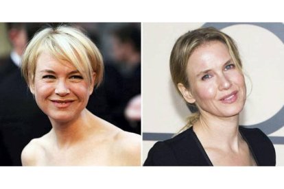 Reneé, en el 2001 y en la actualidad. Foto: AP