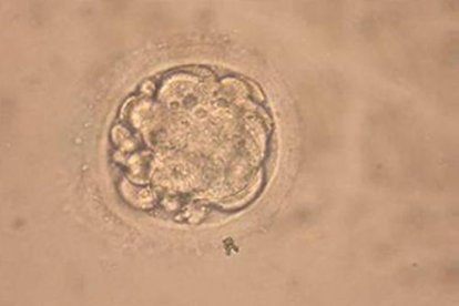 Según Hwang, las células conseguidas son normales, de autorenovación y «pluripotentes», es decir, tienen la capacidad de transformarse en otro tipo de células como las de la retina.