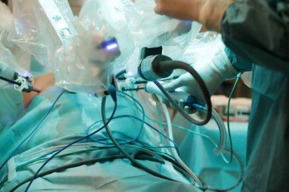 Una de las primeras operaciones de extirpación de la glándula prostática en un paciente con cáncer en el centro médico quirúrgico del Hospital San Juan de Dios, con los especialistas Miguel Ángel Alonso Prieto y Miguel García Sanz al frente. RAMIRO