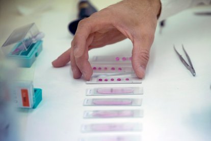 Un estudio de alergia.