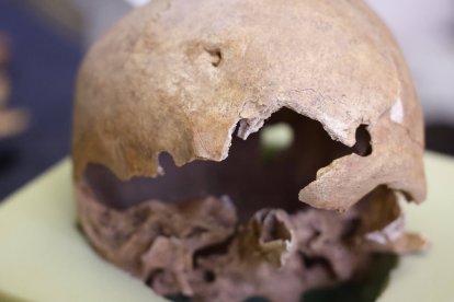 El cráneo de Girón reventado por la bala y cosido por la antropóloga.
