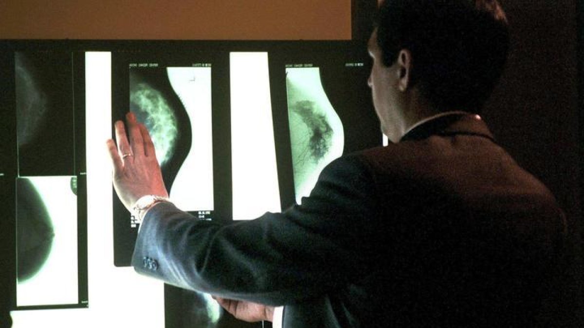 Una persona examina varias mamografias durante un curso internacional de la Sociedad Española de Diagnostico por Imagen de la Mama