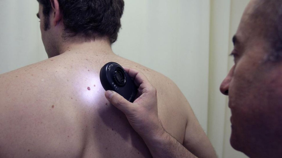 Un médico examina a un paciente para detectar o descartar posibles señales de cáncer de piel.