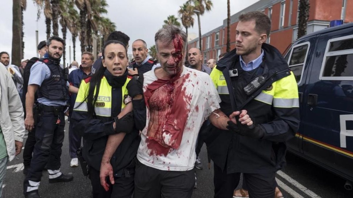 Uno de los heridos en la Escola Mediterrànea de la Barceloneta durante las cartas policiales el 1-O.