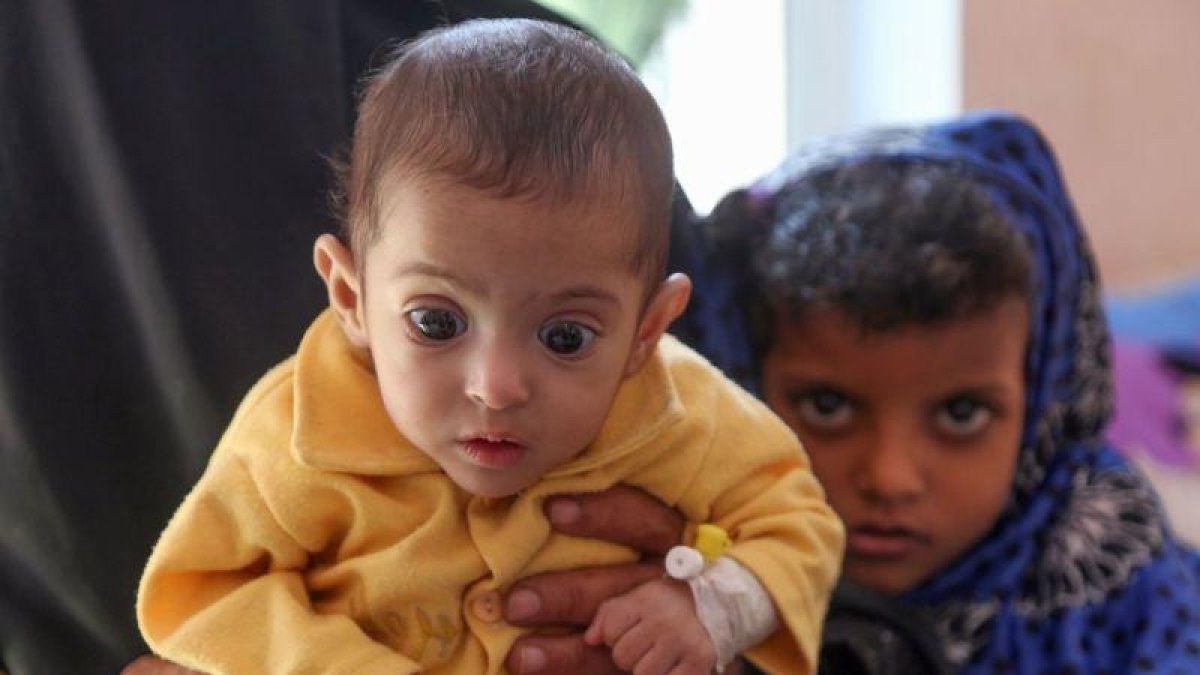 Un niño yemení.