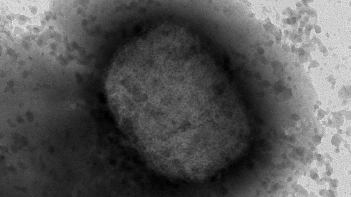 Virus de la viruela del mono por microscopía electrónica, facilitada por el Instituto de Salud Carlos III. DL