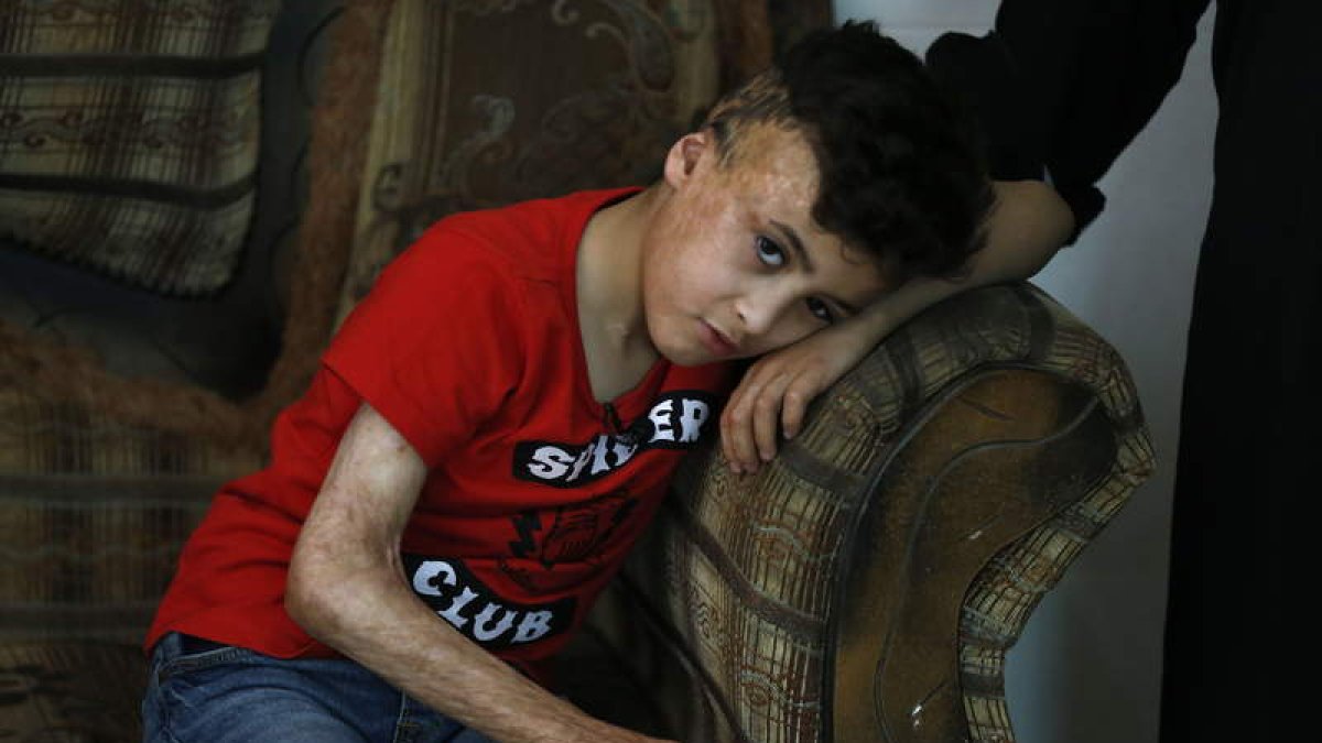 Imagen de un niño herido tras un ataque de colonos. ALAA BADARNEH