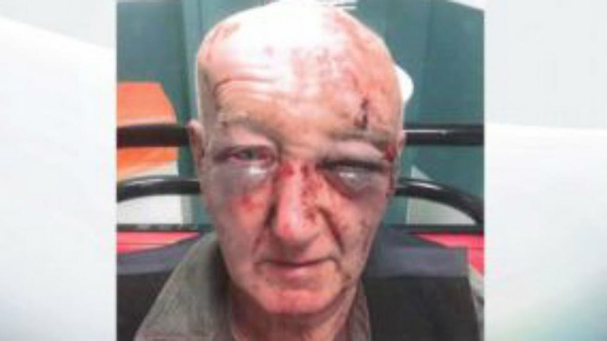 La policía de Manchester ha publicado esta imagen de las lesiones del señor Laidlaw.