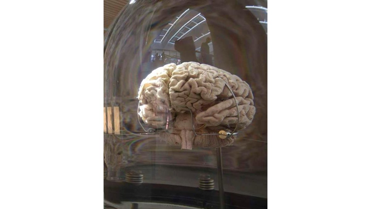 Cerebro expuesto en el Museo de la Evolución Humana. SANTI OTERO