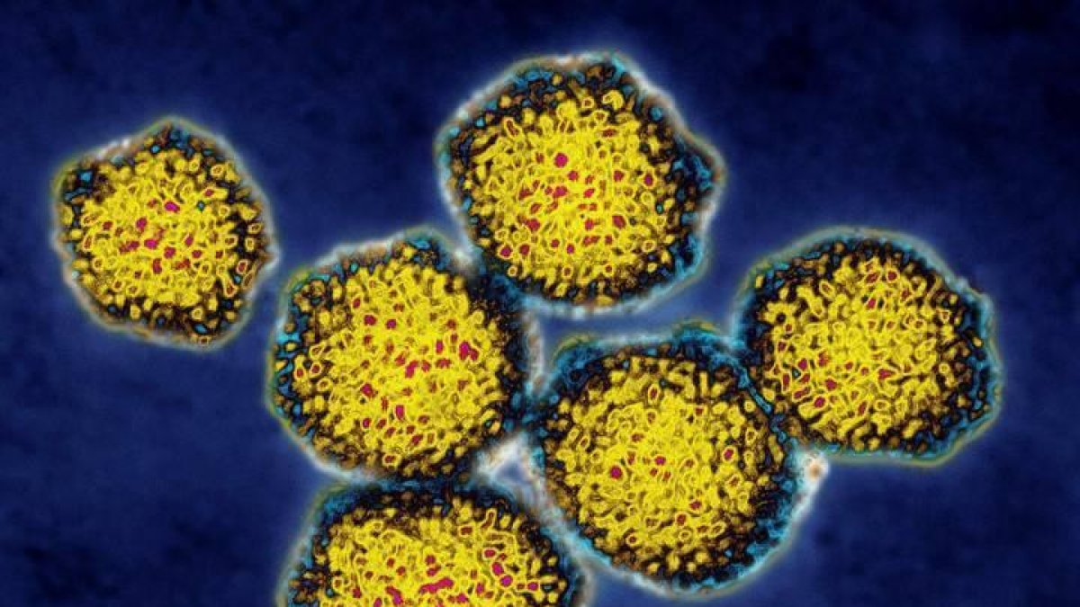 Imagen del virus de la hepatitis C