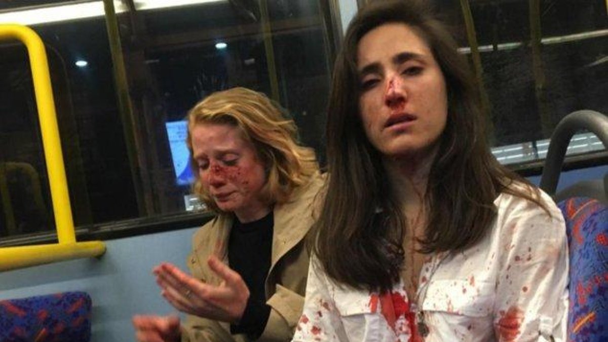 Melania Geymonat y su pareja, tras ser agredidas en un autobús en Londres.