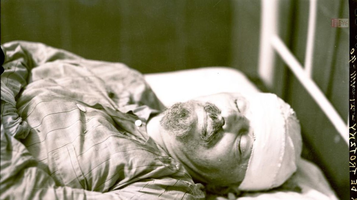 Trotsky, en el hospital, tras sufrir el ataque de Ramón Mercader