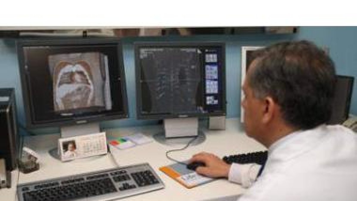 Servicio de radiodiagnóstico del Hospital San Juan de Dios, con el nuevo TAC de 64 cortes.