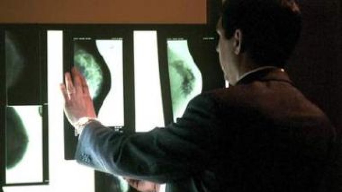 Una persona examina varias mamografías durante un curso sobre diagnóstico por imagen de la mama