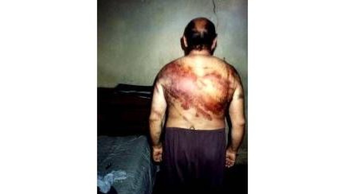 Uno de los presos iraquíes muestra las señales tras ser torturado