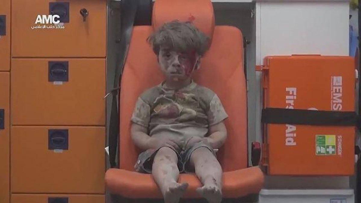 Un niño sirio que sobrevive a un bombardeo aguarda en una ambulancia.