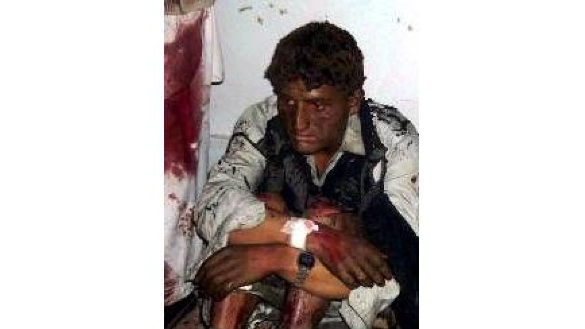 Imagen de uno de los heridos en el atentado de Pakistán