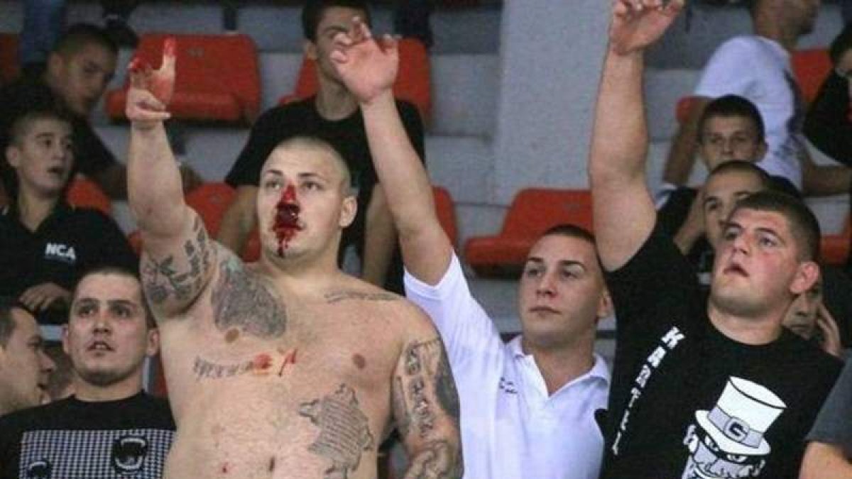 Un hincha radical serbio con el rostro ensangrentado.