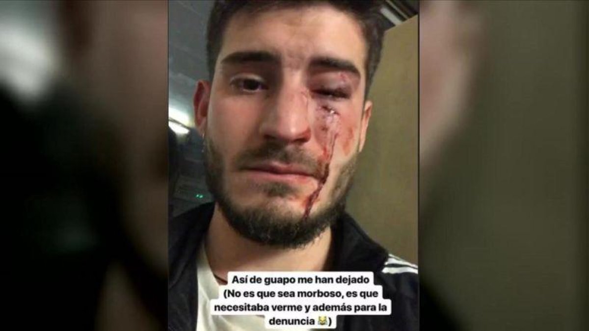 @MartosDiego tras la agresión en el metro, según la imagen que él mismo ha subido a Twitter.