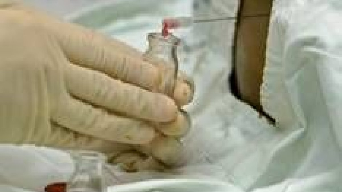 Extracción de una muestra de médula de un paciente