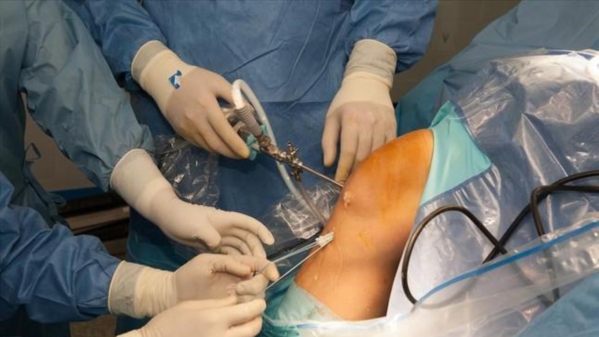 Hospital Universitari de Bellvitge  Una  nueva cirugia que  implanta tejido porcino puede revolucionar el tratamiento de rotuta del ligamento cruzado anterior de la rodilla