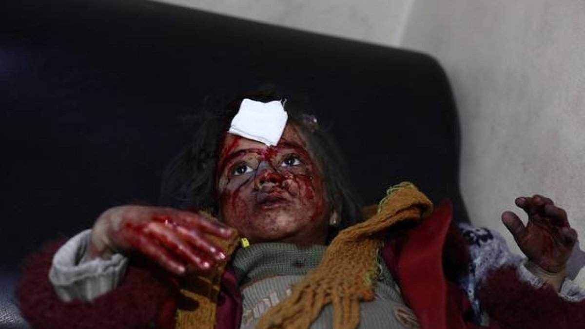 Una niña herida en los bombardeos de este jueves en Ghouta.