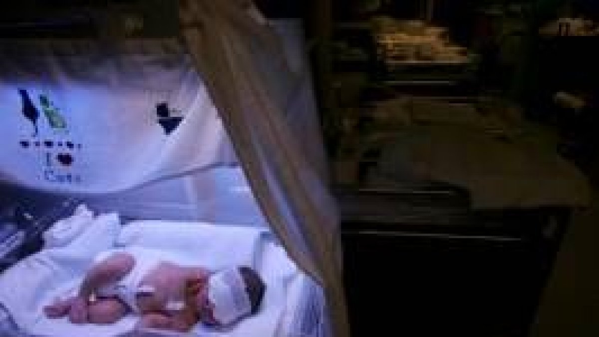 Un recién nacido es sometido a fototerapia para contrarrestar el brote típico de ictericia