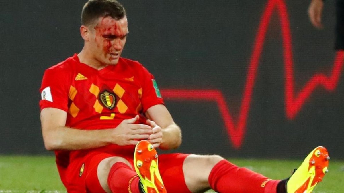 Vermaelen sangra tras una jugada en el partido ante Inglaterra.