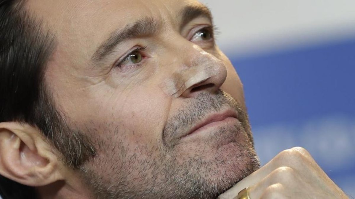 Hugh Jackman muestra las señales de la reciente intervención a que fue sometido para extirpar un carcinoma en la nariz.