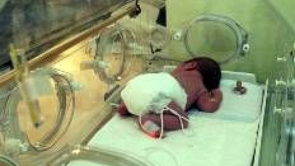 Los bebés prematuros que pesan menos de 1.500 gramos suelen requerir una temporada en la incubadora