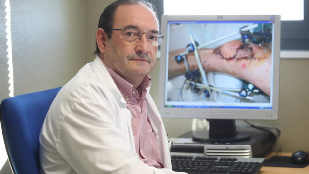 Francisco Linares, jefe del servicio de Cirugía Plástica del Hospital de León y presidente del comité organizador del encuentro. RAMIRO