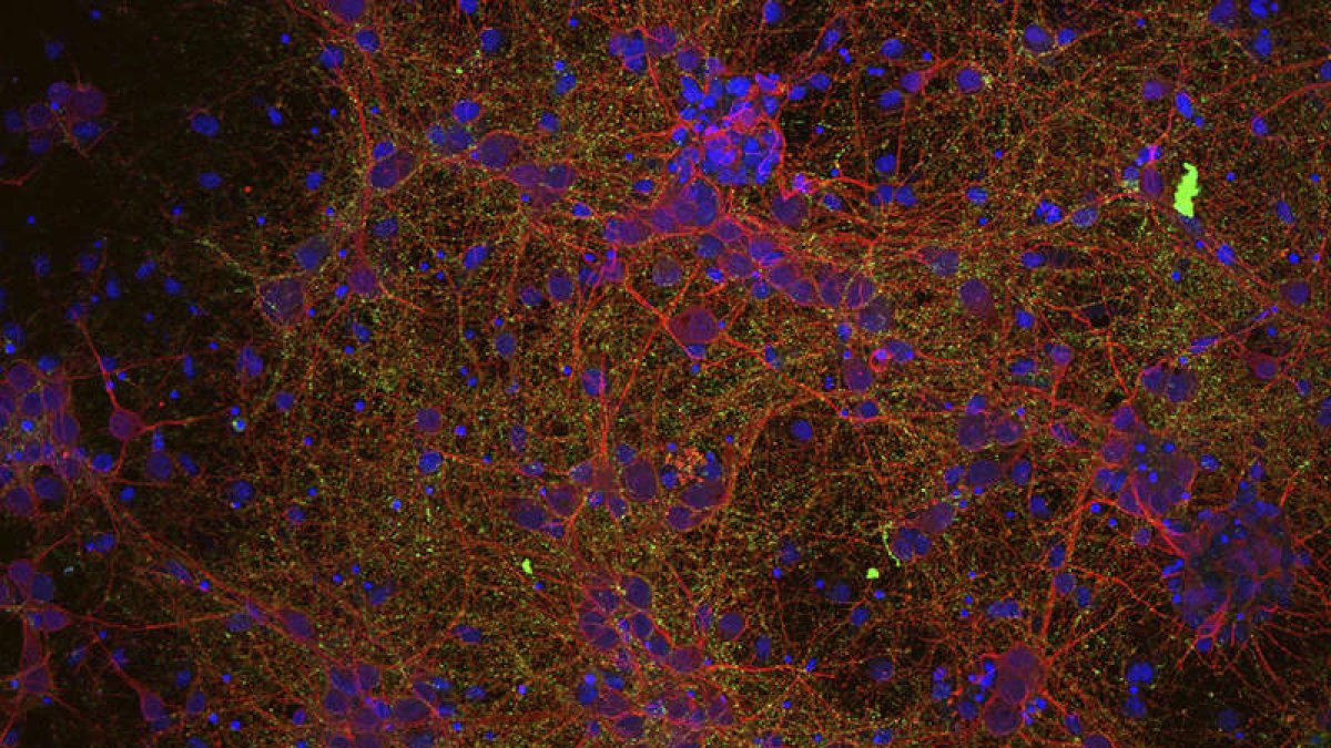 Imagen de los circuitos neuronales. DL