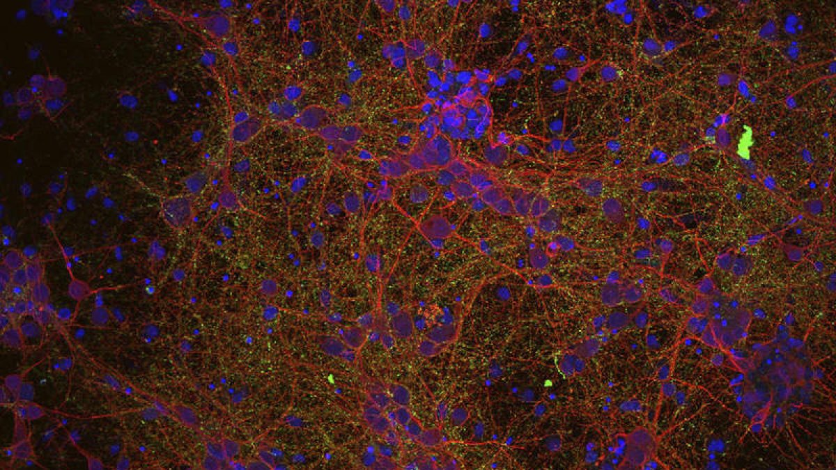 Imagen de un circuito neuronal. efe