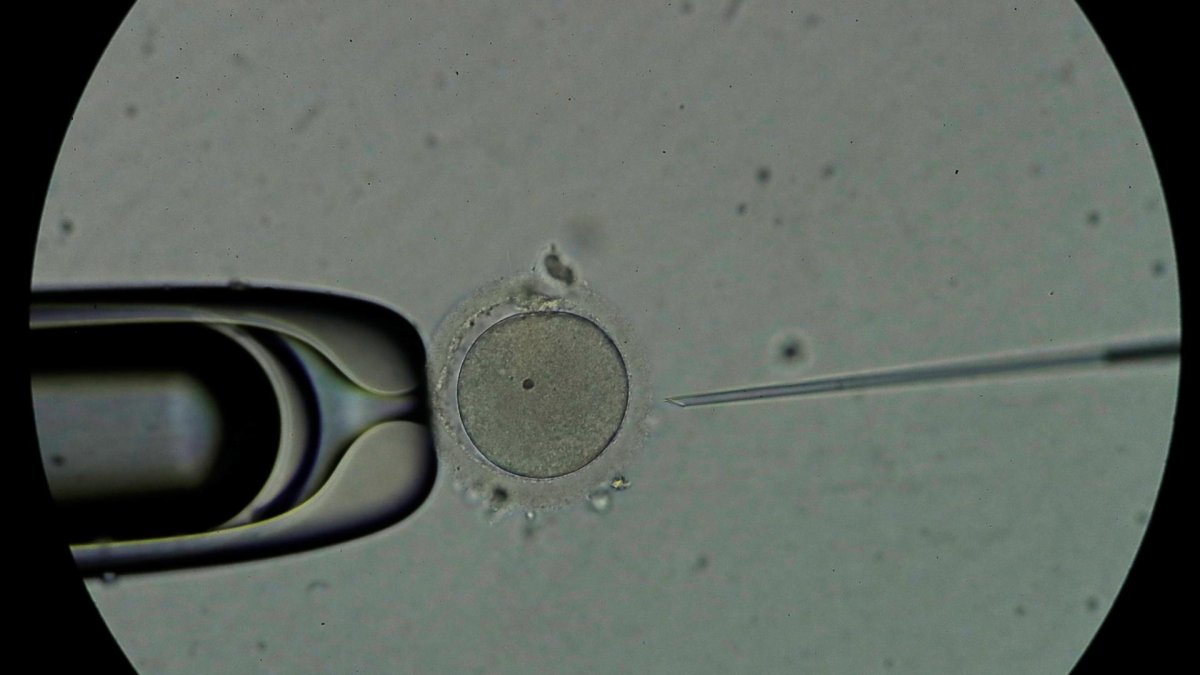 Personal técnico trabaja con espermatozoides en un laboratorio, en una imagen de archivo. EFE/ Bienvenido Velasco