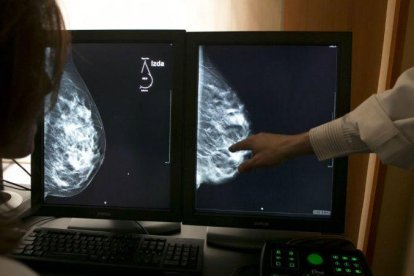 Imagen de archivo de una mamografía en 3D, que permite mejorar la detección del cáncer de mama.