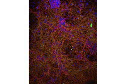 Imagen de una secuencia neuronal. efe