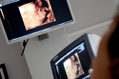 Un estudio investiga las afecciones cardíacas producidas a consecuencia de la exposición prenatal al alcohol. DL