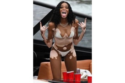 La modelo Winnie Harlow, durante su fiesta de cumpleaños en Miami.