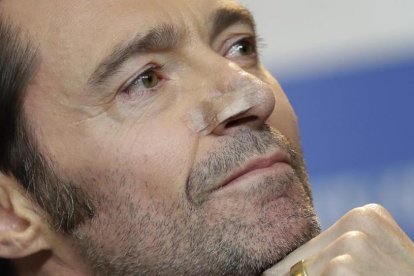 Hugh Jackman muestra las señales de la reciente intervención a que fue sometido para extirpar un carcinoma en la nariz.