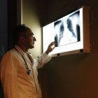La lectura de radiografías de tórax ya se efectúa con IA.