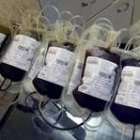 Hasta 150.000 muertes relacionadas con el embarazo pueden evitarse al año con donaciones