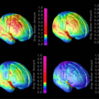 Combo de imágenes que muestran el proceso de maduración del cerebro.