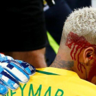Neymar, tras recibir el codazo ante Bolivia.