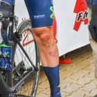 Las cicatrices de Fran Ventoso en la pierna izquierda.
