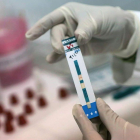 Un médico sostiene una prueba para detectar el sida.