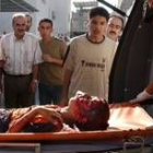 Un joven de 13 años, herido en los bombardeos, es trasladado al hospital
