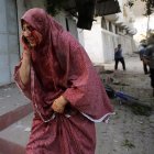 Una mujer herida tras los ataques aéreos en el barrio de Al Tufah en la franja de Gaza.