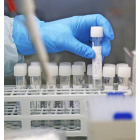 Las moléculas analizadas permiten nuevos usos contra los virus. elvis gonzález