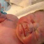 Dexter Tyler, un auténtico 'bebé milagro'.