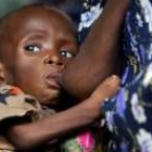 Una mujer de Malawi da el pecho a un niño con sida
